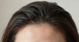 protective scalp shield