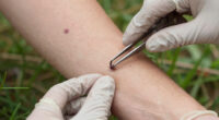 Ticks Are On The Move. Here Are The Risks In Your Region.