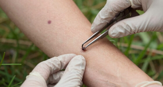Ticks Are On The Move. Here Are The Risks In Your Region.