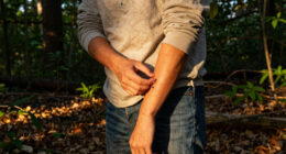 Ticks Are on the Move. Here Are the Risks in Your Region.